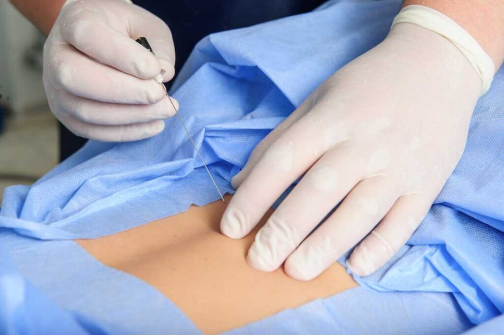 Joint Injections: A Non Surgical Solution for Chronic Joint Pain