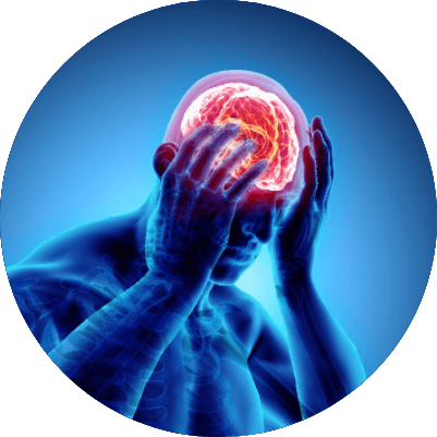 Headache Management